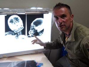 Thierry Jamin avec des radiographies prises de la momie, de type "hybride", surnommée "Maria". (c) Thierry Jamin, mai 2017.